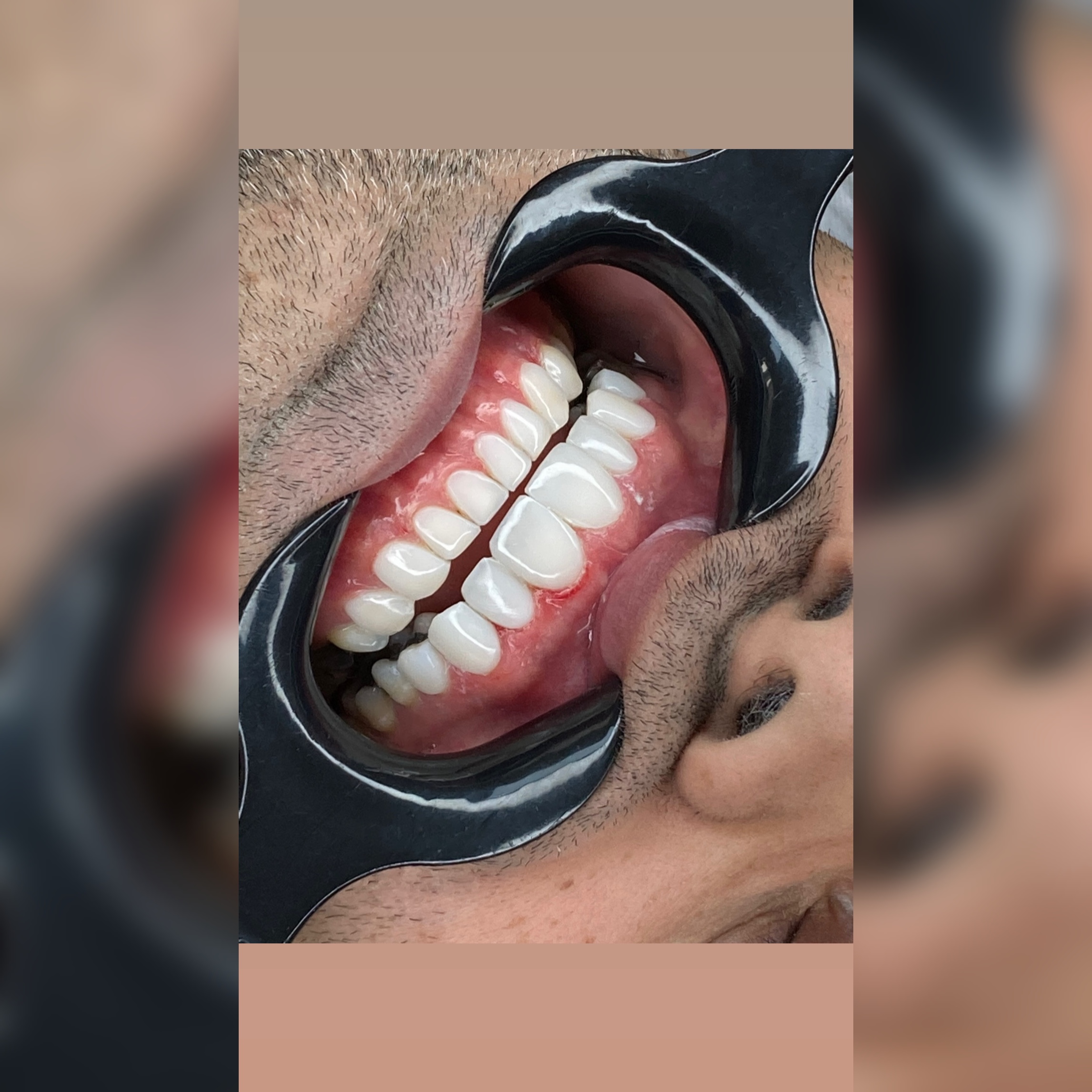 ونیر